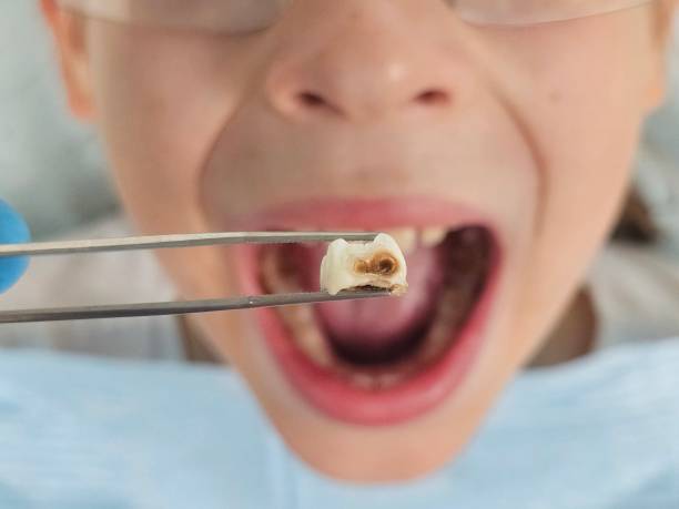 Best Emergency Treatment for Toothache in Earlham, IA